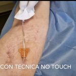 Come eseguire una medicazione del C.I.CC., P.I.C.C., F.I.C.C. Midline e catetere venoso centrale