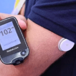 Diabete, ricoveri ospedalieri ridotti grazie al sensore per monitorare il glucosio