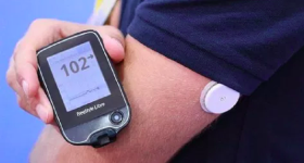 Diabete, ricoveri ospedalieri ridotti grazie al sensore per monitorare il glucosio