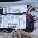 Fu operato a cuore aperto senza trasfusioni di sangue: figlio di testimoni di Geova, oggi 25enne, ha fatto storia insieme al medico che eseguì l'intervento