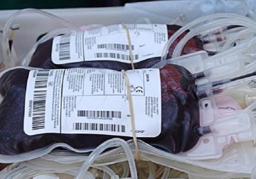 Fu operato a cuore aperto senza trasfusioni di sangue: figlio di testimoni di Geova, oggi 25enne, ha fatto storia insieme al medico che eseguì l'intervento