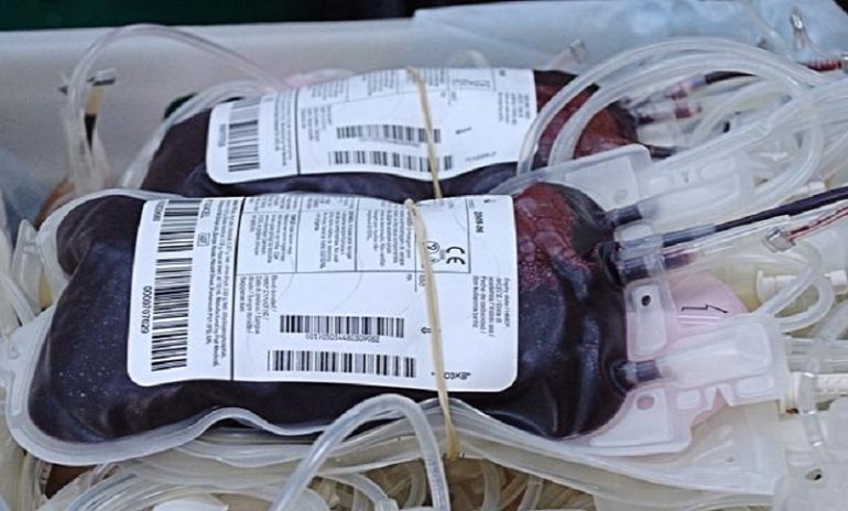 Fu operato a cuore aperto senza trasfusioni di sangue: figlio di testimoni di Geova, oggi 25enne, ha fatto storia insieme al medico che eseguì l'intervento