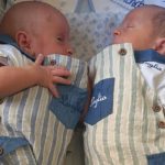 Sindrome da trasfusione feto-fetale, due gemellini operati in utero alla 26esima settimana di gestazione