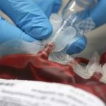 Trasfusione incompatibile, "Medico non presente è responsabile insieme all'infermiera": la sentenza della Cassazione
