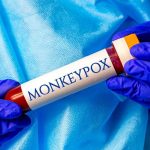 Vaiolo delle scimmie: encefalite e convulsioni tra i possibili sintomi