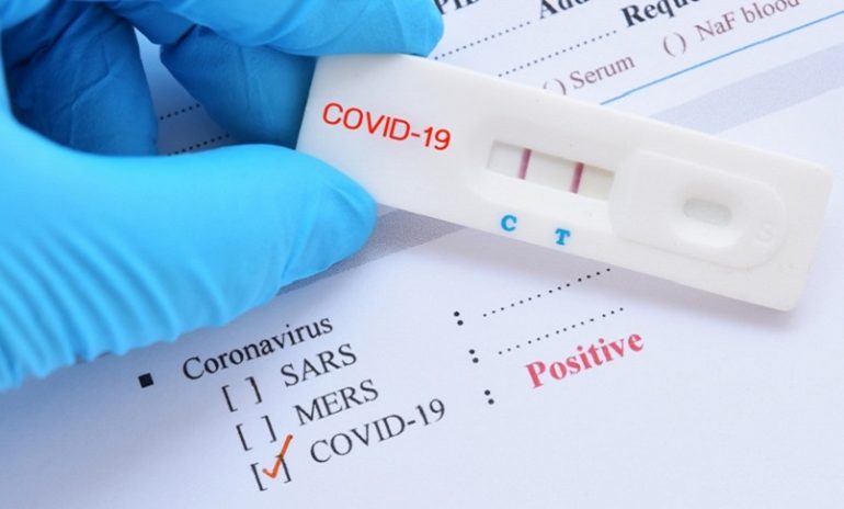 Coronavirus, studio mostra la scarsa efficacia dei test antigenici: falsi negfativi più frequenti