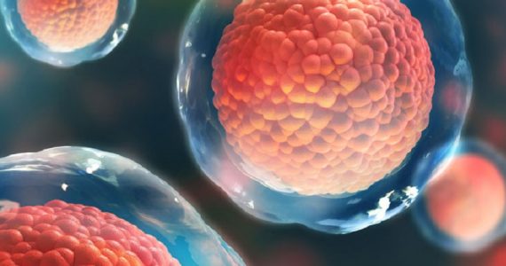 Diabete di tipo 1, è possibile rendere invisibili al sistema immunitario le cellule staminali pluripotenti indotte