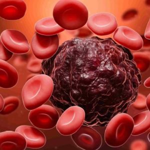 Tumori del sangue: CAR-T e anticorpi bispecifici rivoluzionano la cura