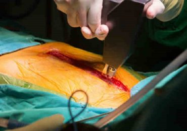 Ferite in cardiochirurgia: problematiche collegate alle infezioni