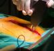Ferite in cardiochirurgia: problematiche collegate alle infezioni