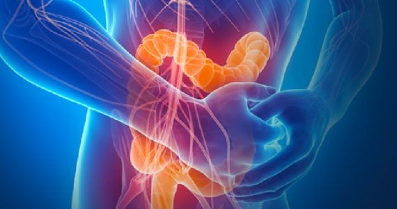 Malattie infiammatorie croniche intestinali (MICI), la nutrizione enterale esclusiva porta alla remissione dei sintomi della malattia di Crohn nell'80% dei casi