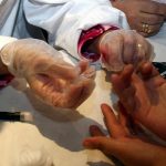 Reintegro dei sanitari non vaccinati, la rabbia dei diabetici bresciani: "Noi pazienti fragili siamo preoccupati"