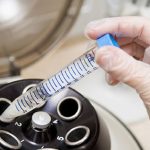 Hiv, il lavaggio del liquido seminale riduce il rischio di trasmissione del virus ai figli