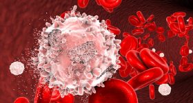 Cellule CAR - Natural Killer: la nuova frontiera della cura "pronta all'uso" per la leucemia mieloide acuta