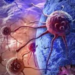 Tumori, nuova molecola può prevenire le metastasi?
