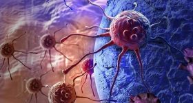 Tumori, nuova molecola può prevenire le metastasi?