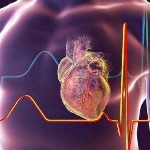 Aneurisma della radice aortica: il trattamento con tecnica Tirone David
