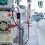 Contrasse epatite C durante emodialisi: risarcita con 160mila euro di arretrati e 800 al mese di quota fissa