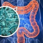 Infezioni batteriche intestinali: come riconoscerle