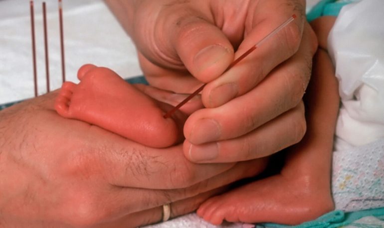 L'emogasanalisi da prelievo di sangue capillare nel neonato