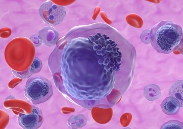 Leucemia mieloide acuta, nuova terapia aumenta la sopravvivenza di 13 volte