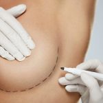 Roma, donna contrasse pericoloso virus durante intervento di chirurgia estetica al seno: medico a rischio processo