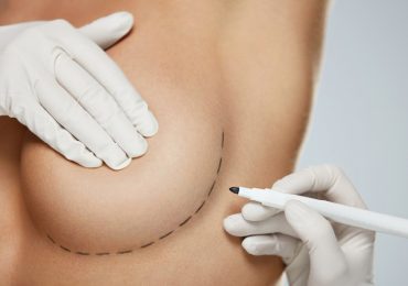 Roma, donna contrasse pericoloso virus durante intervento di chirurgia estetica al seno: medico a rischio processo