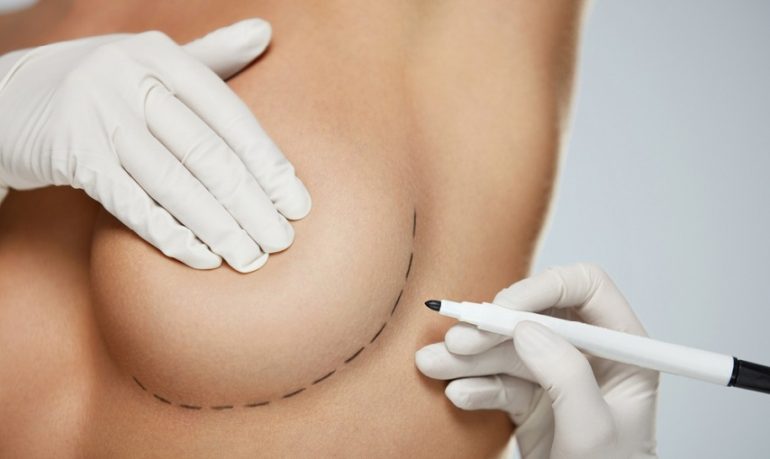 Roma, donna contrasse pericoloso virus durante intervento di chirurgia estetica al seno: medico a rischio processo
