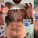 Acerra (Napoli), infermiere travolto dalla furia di 10 visitatori a Villa dei Fiori