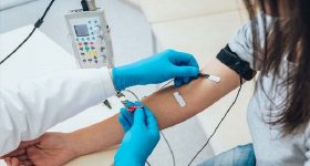 Elettromiografia ed elettroneurografia: conosciamole meglio