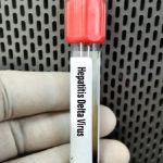 Epatite Delta, specialisti di Aisf e Simit presentano documento congiunto e aggiornato