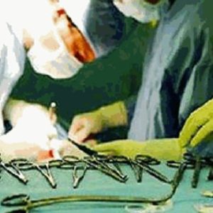 Rissa in sala operatoria e pinza dimenticata nell'addome del paziente: medici e infermieri condannati per danno erariale