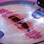 Ferite croniche: guarigione più rapida con la stimolazione elettrica