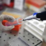 Scoperta nuova malattia rara: finora era scambiata per grave allergia