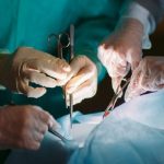 Trapianto di organi: le indicazioni del ministero