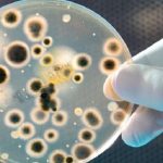 Antibiotico contro l'Acinetobacter baumannii scoperto grazie all'intelligenza artificiale