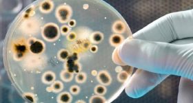Antibiotico contro l'Acinetobacter baumannii scoperto grazie all'intelligenza artificiale