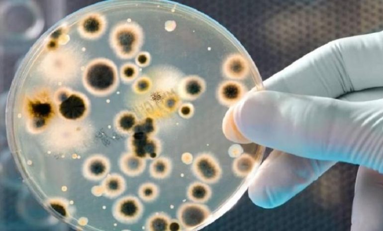 Antibiotico contro l'Acinetobacter baumannii scoperto grazie all'intelligenza artificiale