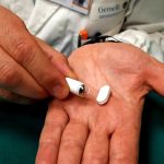 Gastroscopia "senza tubo": al Gemelli l'anteprima mondiale
