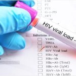 Hiv: nuova terapia intramuscolare con dosaggio semestrale