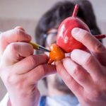 Tumore della prostata: infiammazione cronica tra le possibili cause