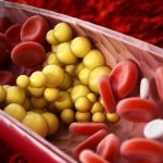 Colesterolemia LDL, inclisiran prescrivibile nel Lazio