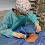 FICC Port e corretto posizionamento della punta con tecnica dell'ECG intracavitario 3