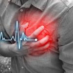 Infarti fatali più comuni di lunedì: lo studio irlandese