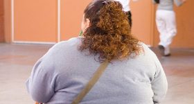 Obesità, l'indice di massa corporea sbaglia metà delle diagnosi
