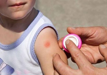 Punture di insetti in età pediatrica: i consigli della SIAIP