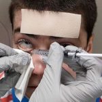 Colliri "miracolosi": adolescente torna a vedere grazie all'intuizione di un medico