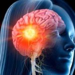 Dna del tumore al cervello catturato nelle urine. Lo studio giapponese