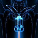 Epididimite e orchiepididimite: sintomi, diagnosi e cura