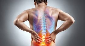 Aou Sassari, fratture vertebrali curate in Radiologia interventistica
